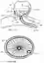 Fig. 09 - ANEURYSM OCCLUSION DEVICE