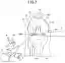 Fig. 06 - ULTRASONIC PROBE