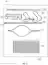 Fig. 02 - Kits for surgical repair of soft tissue defects and components, packaging, and methods of use thereof