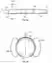 Fig. 07 - Kits for surgical repair of soft tissue defects and components, packaging, and methods of use thereof