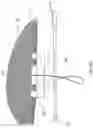Fig. 16 - Kits for surgical repair of soft tissue defects and components, packaging, and methods of use thereof
