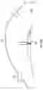 Fig. 20 - Kits for surgical repair of soft tissue defects and components, packaging, and methods of use thereof