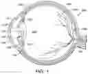 Fig. 02 - Aspherical multifocal intraocular lens