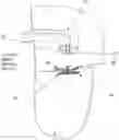 Fig. 01 - SYSTEMS AND METHODS FOR HEART VALVE REPAIR