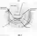Fig. 02 - SYSTEMS AND METHODS FOR HEART VALVE REPAIR