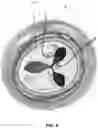 Fig. 06 - SYSTEMS AND METHODS FOR HEART VALVE REPAIR