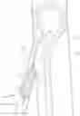 Fig. 01 - Guiding sheath system and method of delivering an endovascular device using the same