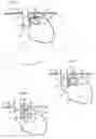 Fig. 02 - Apparatus for treating gerd