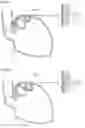 Fig. 06 - Apparatus for treating gerd