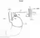 Fig. 45 - Apparatus for treating gerd