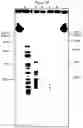 Fig. 46 - COMPOSITIONS COMPRISING BACTERIAL STRAINS