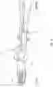 Fig. 08 - Rapidly insertable central catheters including catheter assemblies and methods thereof