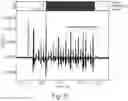 Fig. 06 - NEUROMODULATION SYSTEM FOR PLANNING AND/OR ADJUSTING AND/OR PROVIDING A NEUROMODULATION THERAPY