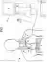 Fig. 02 - Intravascular catheter methods