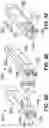 Fig. 07 - Electrical stimulation device with minimally invasive delivery