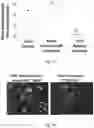 Fig. 06 - Ultra-soft coatings for interfaces with brain and other soft tissues