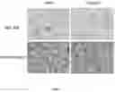 Fig. 02 - Continuous stable cell line for identification of infectious African swine fever virus in clinical samples