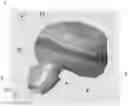 Fig. 01 - Earphone with a vent