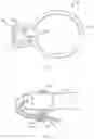 Fig. 04 - WIRE BIASING GUIDE FOR A MEDICAL DEVICE
