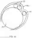 Fig. 08 - WIRE BIASING GUIDE FOR A MEDICAL DEVICE