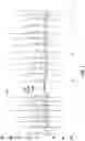 Fig. 07 - Arrhythmia detection with feature delineation and machine learning