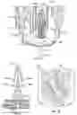 Fig. 76 - TRANSCUTANEOUS ANALYTE SENSORS, APPLICATORS THEREFOR, AND ASSOCIATED METHODS