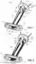 Fig. 02 - Knotless orthopedic stabilization system