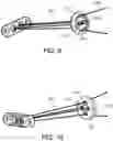 Fig. 07 - Knotless orthopedic stabilization system