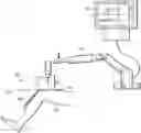 Fig. 01 - Robotically-assisted surgical guide