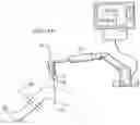 Fig. 06 - Robotically-assisted surgical guide