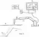 Fig. 08 - Robotically-assisted surgical guide