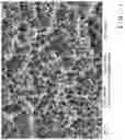 Fig. 02 - Body made of titanium or a titanium alloy having a topography for improved blood coagulation and/or cell attachment
