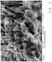 Fig. 06 - Body made of titanium or a titanium alloy having a topography for improved blood coagulation and/or cell attachment