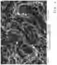 Fig. 07 - Body made of titanium or a titanium alloy having a topography for improved blood coagulation and/or cell attachment