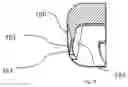 Fig. 06 - Talar Ankle Implant