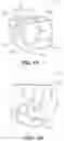 Fig. 02 - Ambidextrous Convertible Packaging