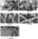 Fig. 02 - Electrolytic Devices and Methods for Dry Hydrogen Peroxide Production