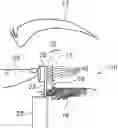 Fig. 01 - METHOD AND DEVICE FOR SELF-MEASUREMENT OF INTRA-OCULAR PRESSURE