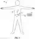 Fig. 02 - Patient-specific calibration of pain quantification