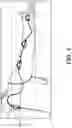 Fig. 02 - REMOTE REHABILITATION SYSTEM