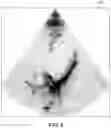 Fig. 07 - Automatically identifying anatomical structures in medical images in a manner that is sensitive to the particular view in which each image is captured