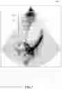 Fig. 08 - Automatically identifying anatomical structures in medical images in a manner that is sensitive to the particular view in which each image is captured
