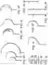 Fig. 05 - Automated, selectable, soft tissue excision biopsy devices and methods