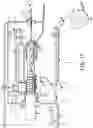 Fig. 16 - Automated, selectable, soft tissue excision biopsy devices and methods