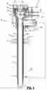 Fig. 03 - Surgical access device including alternating cutout fluid flow pathway for anchor inflation and deflation