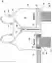 Fig. 02 - Post operation mastectomy bra