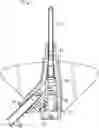 Fig. 01 - Systems and methods to improve instrument guidance within an intravenous catheter assembly