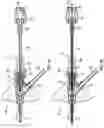 Fig. 16 - Systems and methods to improve instrument guidance within an intravenous catheter assembly