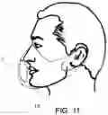 Fig. 09 - Electronic microbicidal air filter