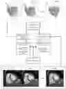 Fig. 01 - METHOD FOR DETECTING ADVERSE CARDIAC EVENTS